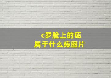 c罗脸上的痣属于什么痣图片