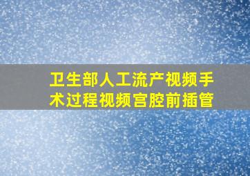 卫生部人工流产视频手术过程视频宫腔前插管