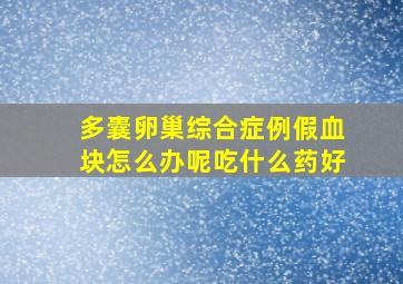 多囊卵巢综合症例假血块怎么办呢吃什么药好