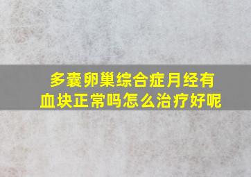 多囊卵巢综合症月经有血块正常吗怎么治疗好呢