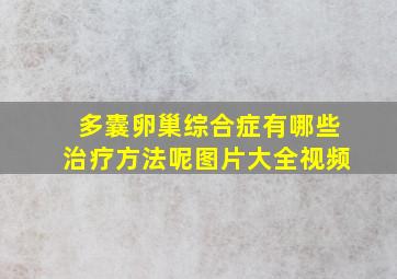 多囊卵巢综合症有哪些治疗方法呢图片大全视频