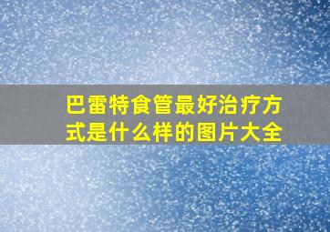 巴雷特食管最好治疗方式是什么样的图片大全