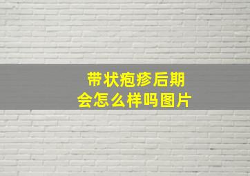 带状疱疹后期会怎么样吗图片