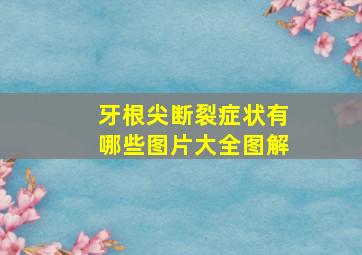 牙根尖断裂症状有哪些图片大全图解