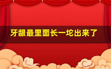 牙龈最里面长一坨出来了