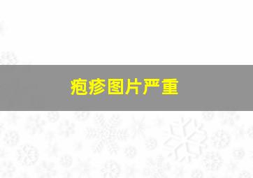 疱疹图片严重