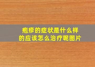 疱疹的症状是什么样的应该怎么治疗呢图片