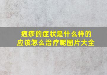 疱疹的症状是什么样的应该怎么治疗呢图片大全