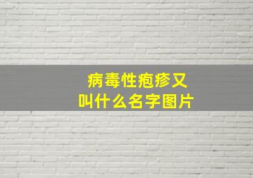 病毒性疱疹又叫什么名字图片