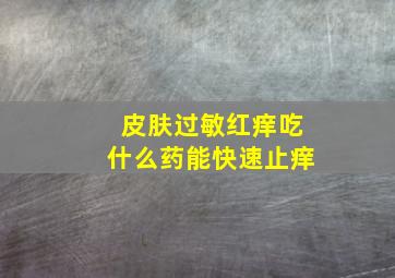 皮肤过敏红痒吃什么药能快速止痒