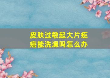 皮肤过敏起大片疙瘩能洗澡吗怎么办