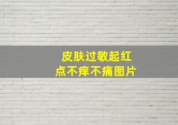 皮肤过敏起红点不痒不痛图片