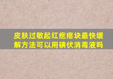 皮肤过敏起红疙瘩块最快缓解方法可以用碘伏消毒液吗