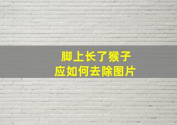 脚上长了猴子应如何去除图片