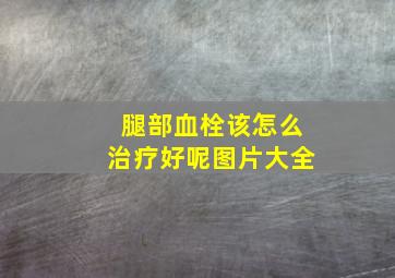 腿部血栓该怎么治疗好呢图片大全