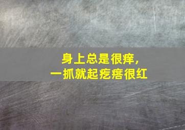 身上总是很痒,一抓就起疙瘩很红