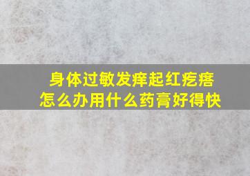 身体过敏发痒起红疙瘩怎么办用什么药膏好得快