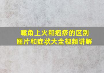 嘴角上火和疱疹的区别图片和症状大全视频讲解