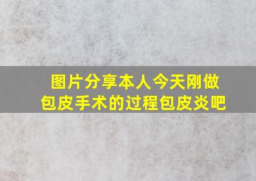 图片分享本人今天刚做包皮手术的过程包皮炎吧