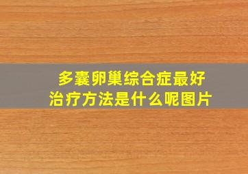 多囊卵巢综合症最好治疗方法是什么呢图片