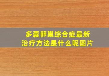 多囊卵巢综合症最新治疗方法是什么呢图片