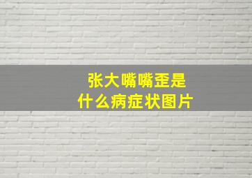 张大嘴嘴歪是什么病症状图片