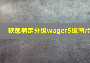 糖尿病足分级wager5级图片