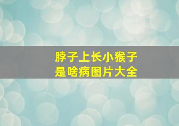 脖子上长小猴子是啥病图片大全