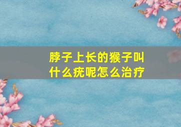 脖子上长的猴子叫什么疣呢怎么治疗