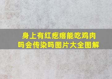 身上有红疙瘩能吃鸡肉吗会传染吗图片大全图解