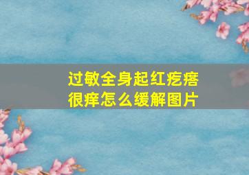 过敏全身起红疙瘩很痒怎么缓解图片