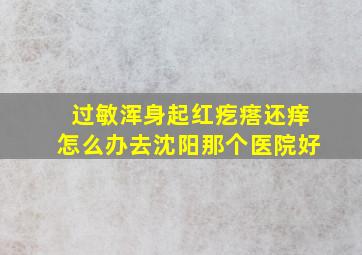 过敏浑身起红疙瘩还痒怎么办去沈阳那个医院好